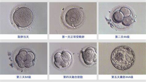 试管婴儿为何会失败？