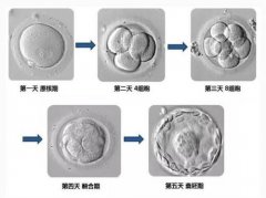 试管婴儿术后流产的概率高吗？