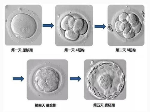 试管婴儿,流产概率,试管婴儿成功率