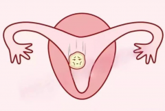 试管不成功，查免疫全套要多少钱？