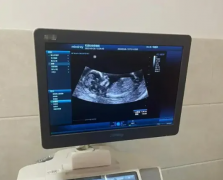 想知道是女儿还是儿子？其实b超单早就告诉你了